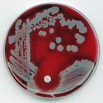 e coli bacteria